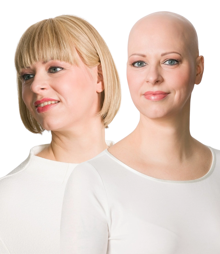 Frau mit Chemotherapie-bedingtem Haarausfall im Vergleich mit und ohne blonde Perücke vor neutralem Hintergrund